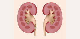 Диета (стол) номер 6