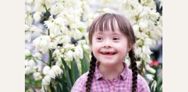 Синдром Дауна. Причины, симптомы и признаки, диагностика патологии, уход за больным.