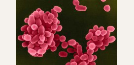 Бруцеллез - причины, симптомы и признаки, диагностика и лечение патологии