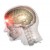 Ушиб головного мозга - симптомы, признаки, первая помощь, степени повреждения