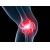 Артроз коленного сустава - причины, симптомы, диагностика и лечение артроза