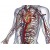 Аневризма грудной аорты. Симптомы, диагностика и лечение патологии