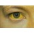 Желтые глаза. Причины желтизны белков глаз, диагностика причин, лечение патологий