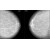 Маммография - показания к обследованию, противопоказания, расшифровка