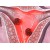 Рак тела матки. Симптомы и признаки, причины, стадия, профилактика болезни