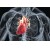 Аортальный клапан и его пороки