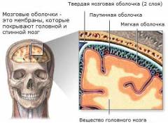 polismed.com, менингит., причины,, симптомы,, диагностика, и, лечение