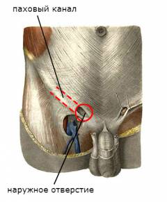 Хирургическая анатомия паховой грыжи
