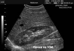 Как проходит узи почек