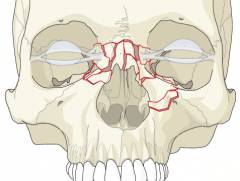 Виды переломов костей носа