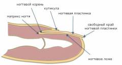 Отек после удаления вросшего ногтя