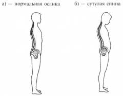 Что значит сутулый человек. Смотреть фото Что значит сутулый человек. Смотреть картинку Что значит сутулый человек. Картинка про Что значит сутулый человек. Фото Что значит сутулый человек