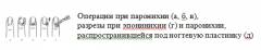 Чем лечить ногтевой панариций. Смотреть фото Чем лечить ногтевой панариций. Смотреть картинку Чем лечить ногтевой панариций. Картинка про Чем лечить ногтевой панариций. Фото Чем лечить ногтевой панариций