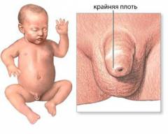 Как сделать крайнюю плоть эластичной