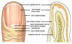 Как вылечить запущенный вросший ноготь на ноге