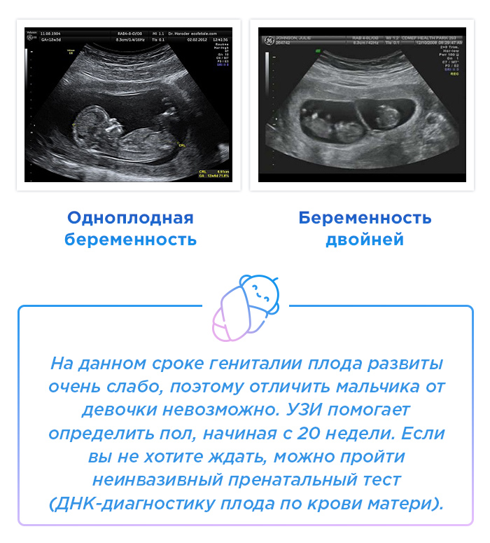 Определение пола 12 недель