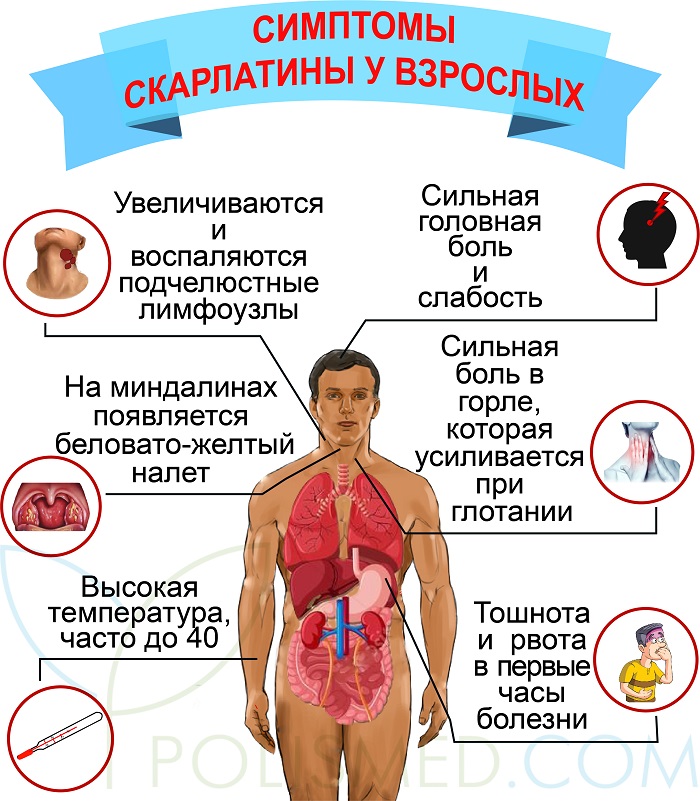 Как проявляется скарлатина