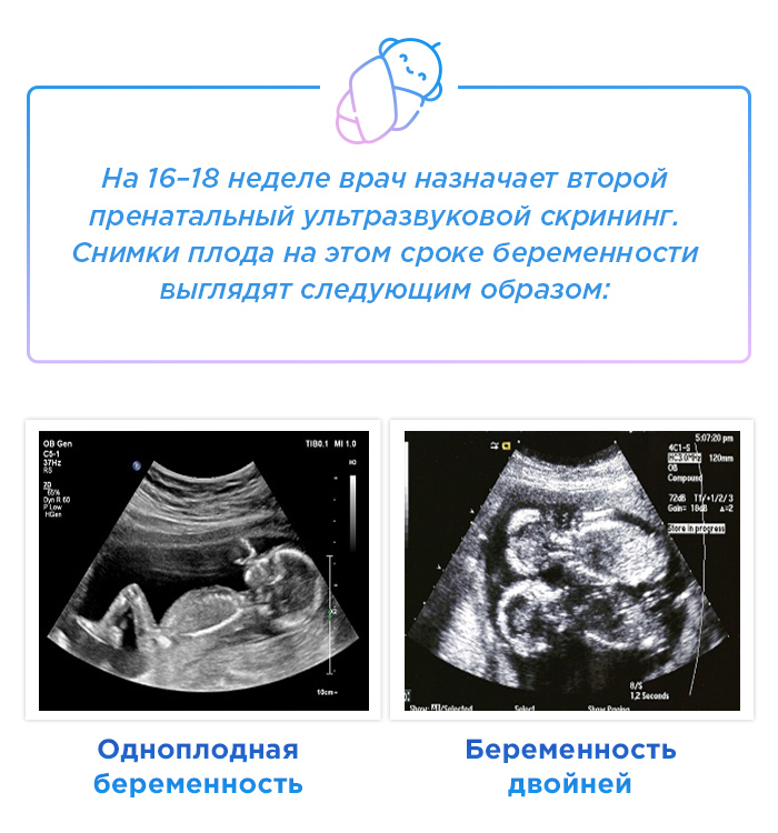 Размер плода 16 недель фото