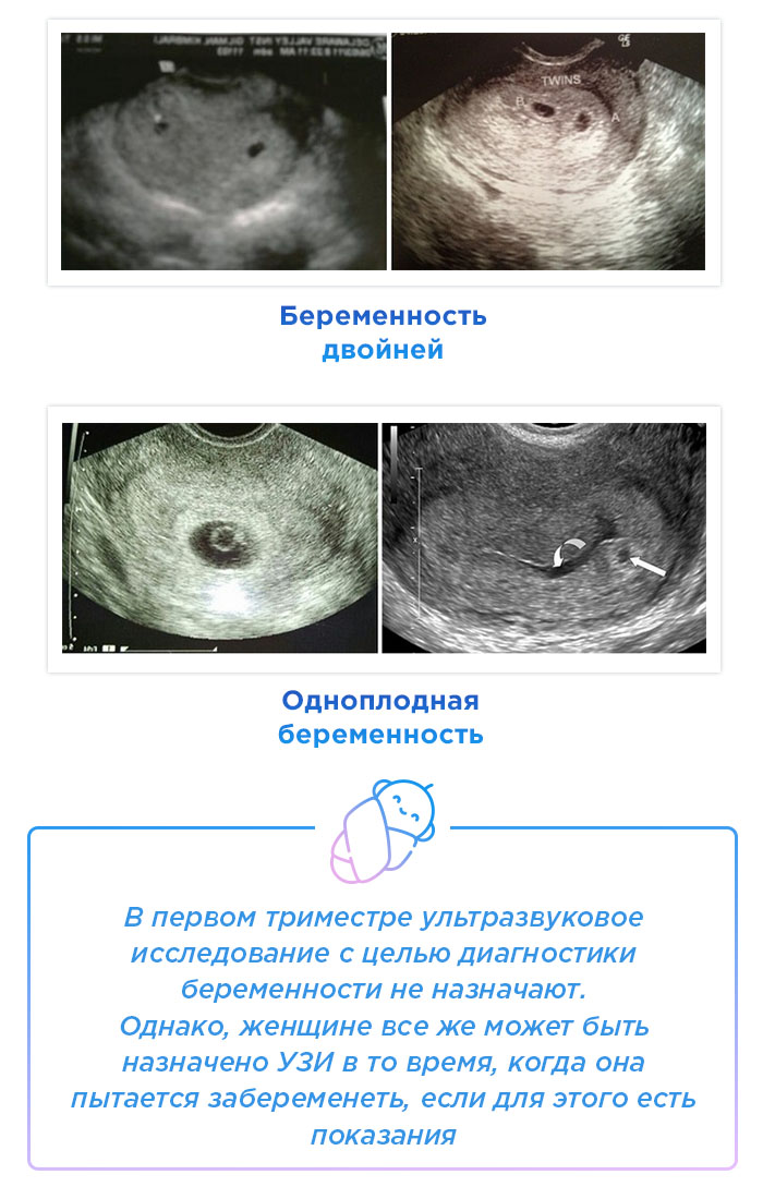 1 неделя беременности