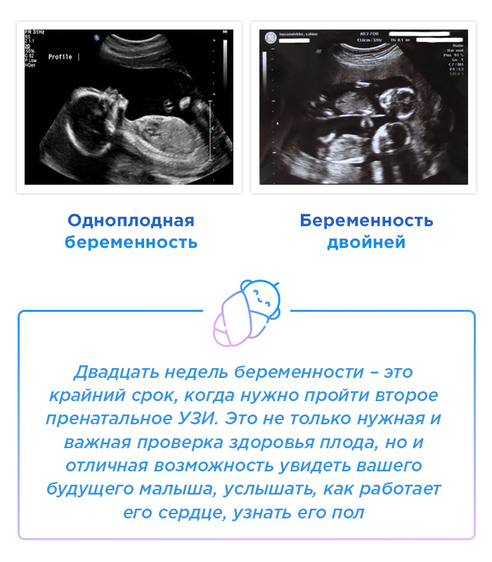 двадцать недель беременности что происходит. Смотреть фото двадцать недель беременности что происходит. Смотреть картинку двадцать недель беременности что происходит. Картинка про двадцать недель беременности что происходит. Фото двадцать недель беременности что происходит