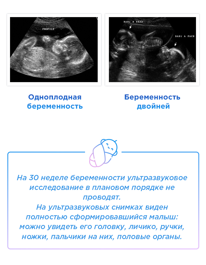 Беременность 30 недель кровь. УЗИ 30 недель беременности. 30 Недель беременности УЗИ плода. УЗИ ребенка 30 недель беременности. Как выглядит ребенок на УЗИ В 32 недели.