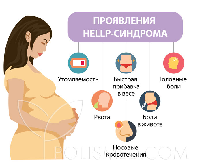 Болит яичник во время беременности. Осложнения Hellp синдрома. Хелп синдром симптомы. Hellp синдром при беременности. Hellp синдром клиника.