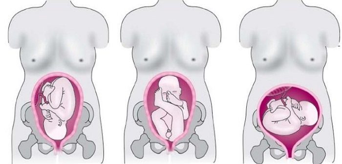различные положения плода в матке