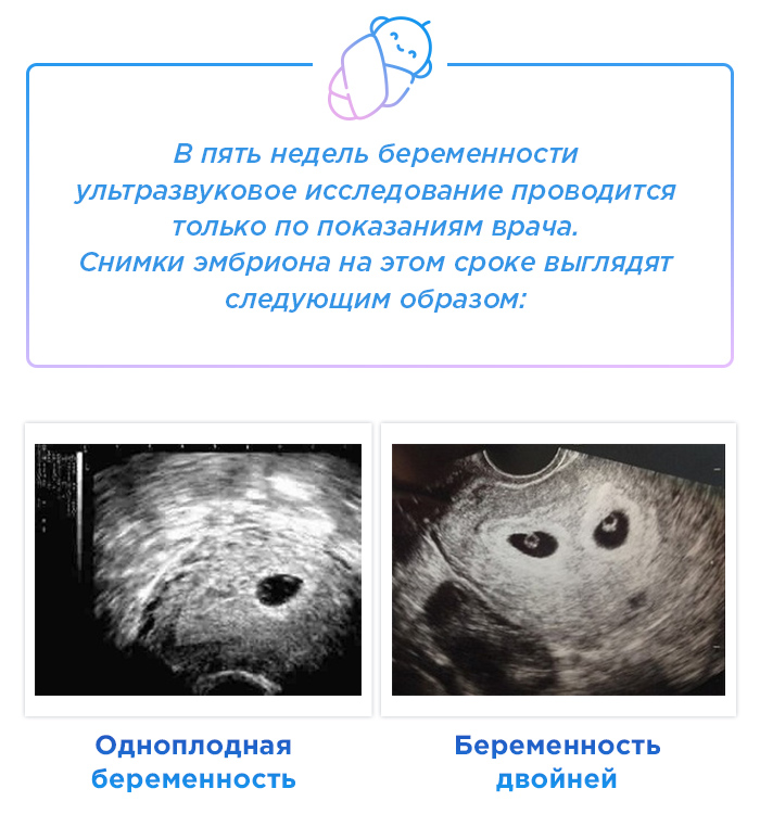 5 недель 5 дней беременности что происходит
