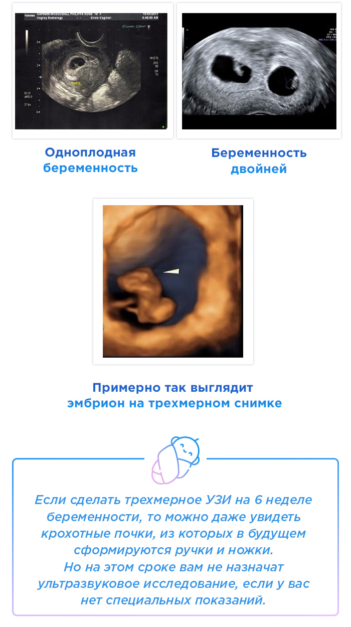 6 эмбриональная неделя. Как выглядит ребёнок на УЗИ В 6 недель. Плод 6 недель беременности размер плода. Размер зародыша на 6 неделе беременности. Одноплодная беременность 6 недель УЗИ.