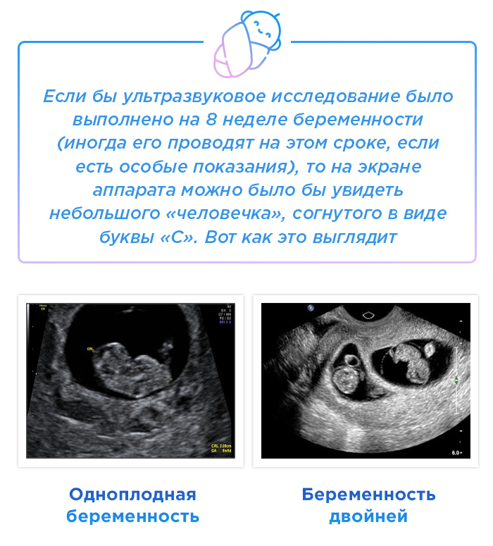 На 8 неделе на данном. УЗИ 8 недель. УЗИ 8 недель беременности. 7-8 Недель беременности по УЗИ. 8 Недель беременности по УЗИ.