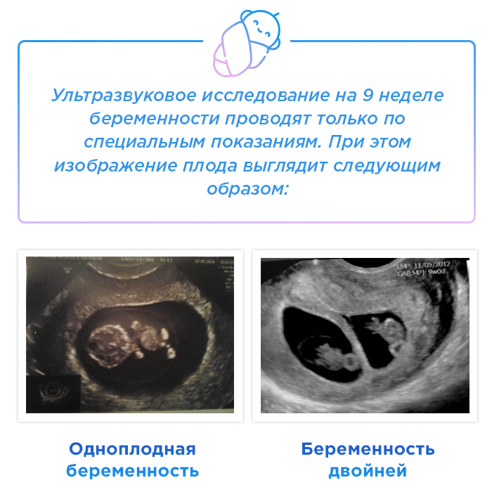 Девятая акушерская беременности что происходит. Смотреть фото Девятая акушерская беременности что происходит. Смотреть картинку Девятая акушерская беременности что происходит. Картинка про Девятая акушерская беременности что происходит. Фото Девятая акушерская беременности что происходит