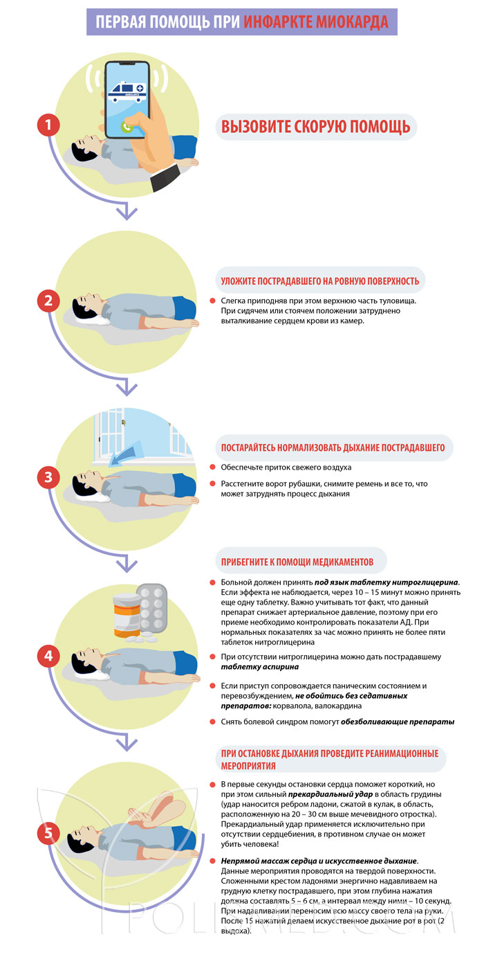 После инфаркта отекает рука