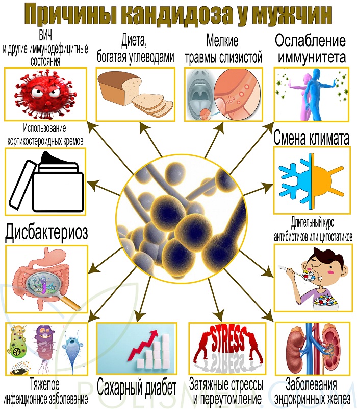 Причины кандидоза у мужчин
