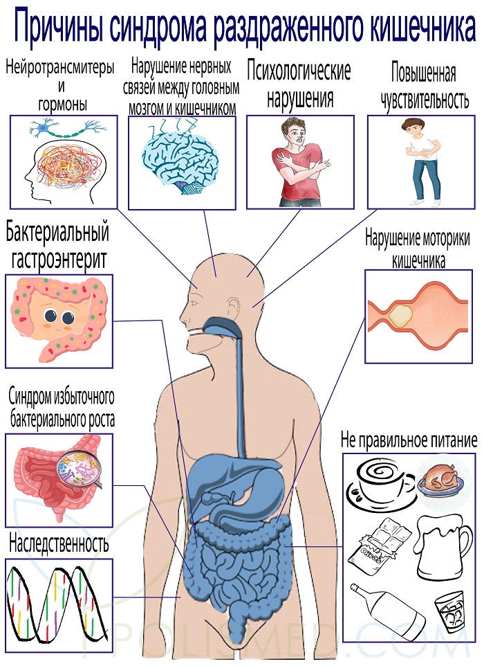 Лечение раздраженного кишечника у мужчин. Синдром раздраженного кишечника клиническая картина. Синдром раздражённого кишечника симптомы. СРК причины. Причины раздраженного кишечника.