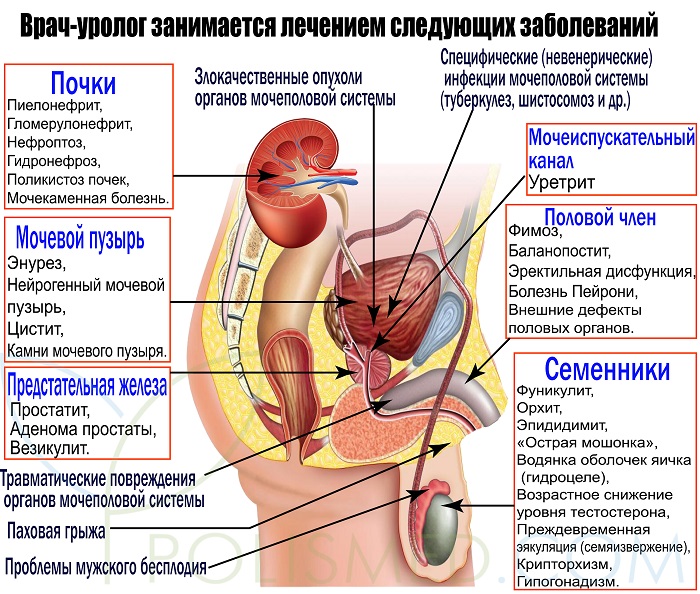 Какие болезни лечит уролог