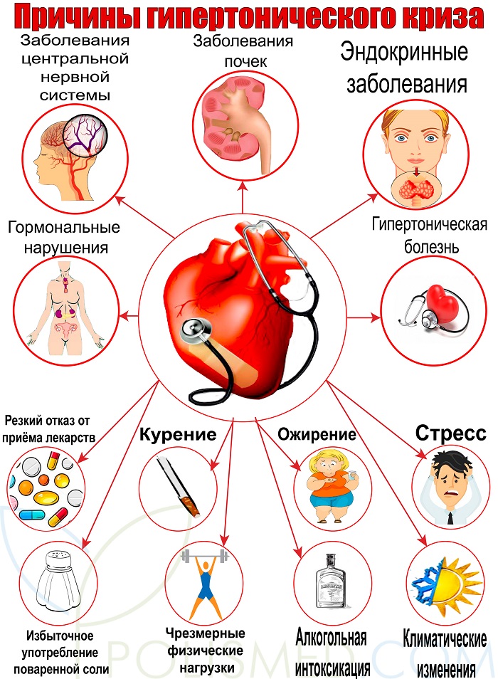 Причины гипертонического криза