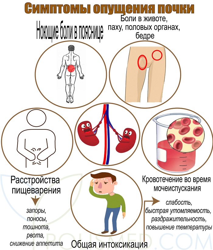 Может ли болеть одна почка