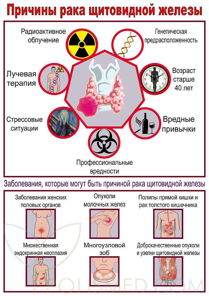 Основные причины рака. Факторы риска заболеваний щитовидной железы. Факторы риска развития заболеваний щитовидной железы. Причины возникновения онкологии. Причины заболевания онкологией.