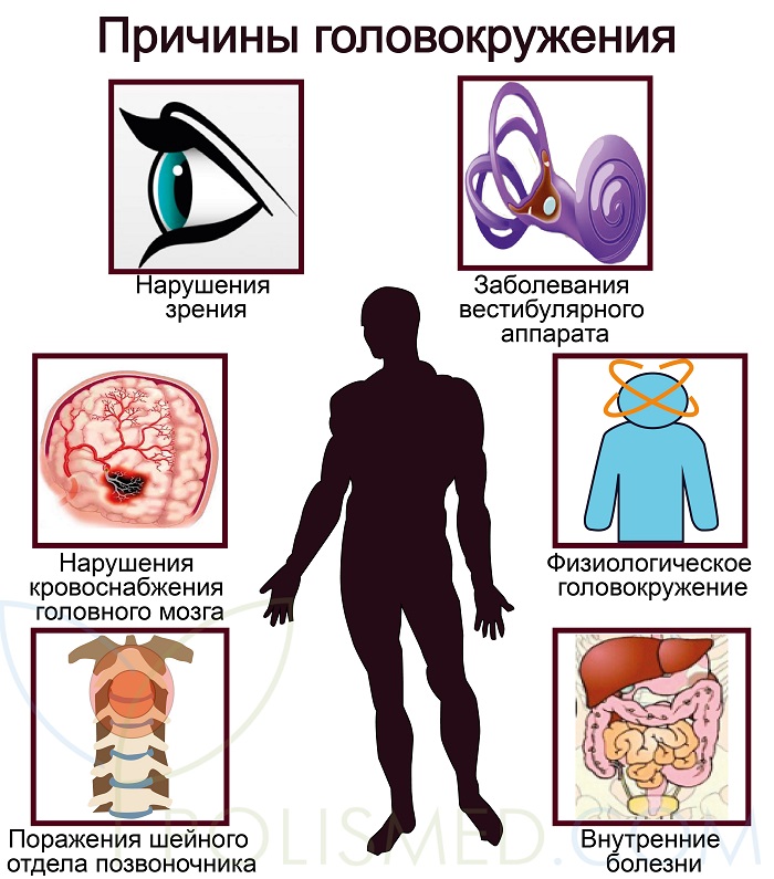 Причины головокружения