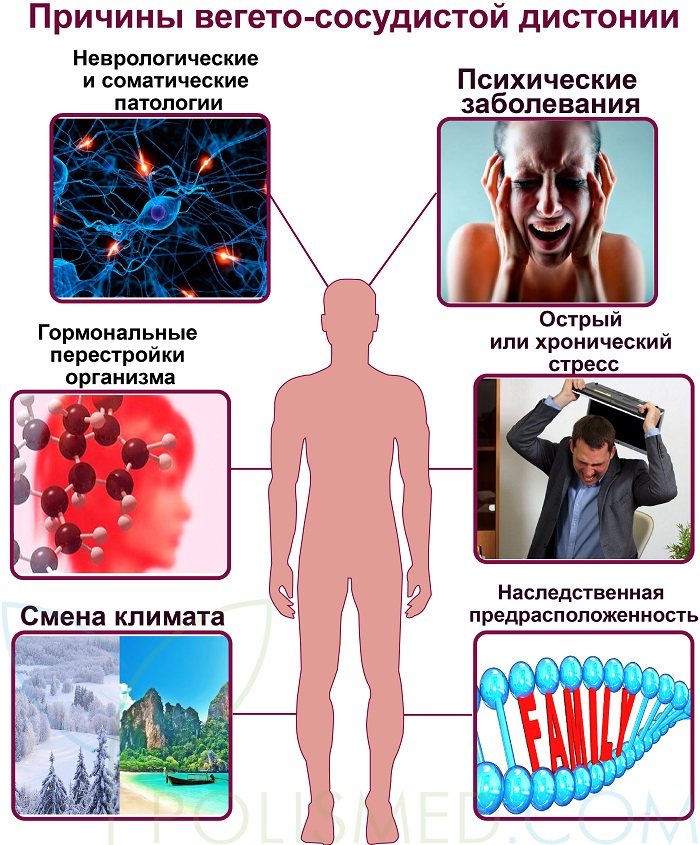 Вегето-сосудистая дистония. Причины, симптомы и лечение пато