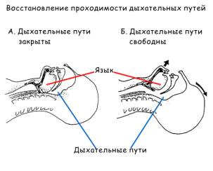 Тошнит от удара током