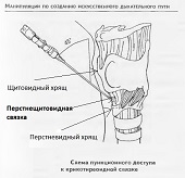 Признаки заболевания отек квинке