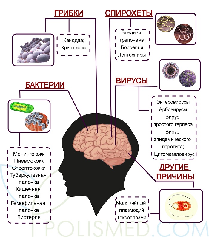 polismed.com, менингит., причины,, симптомы,, диагностика, и, лечение