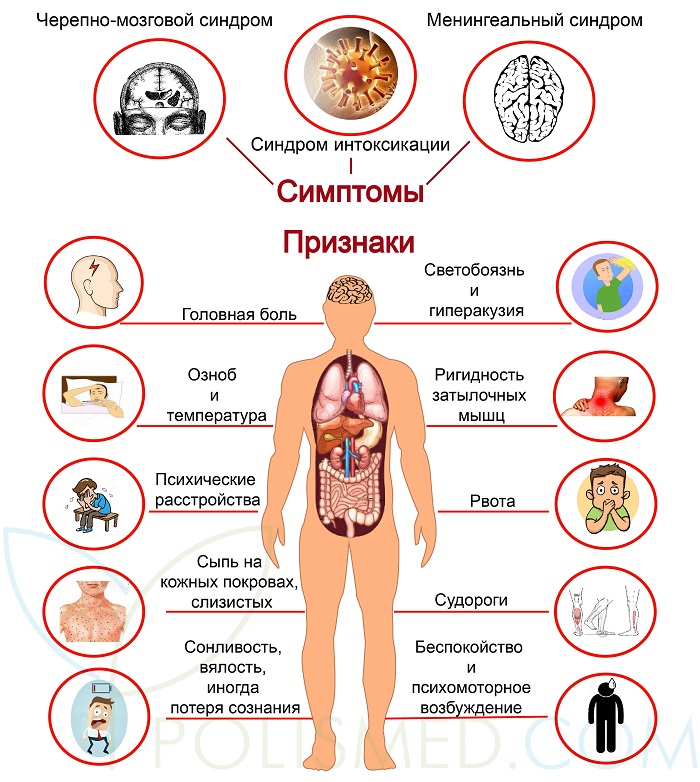 Признаки и симптомы менингита