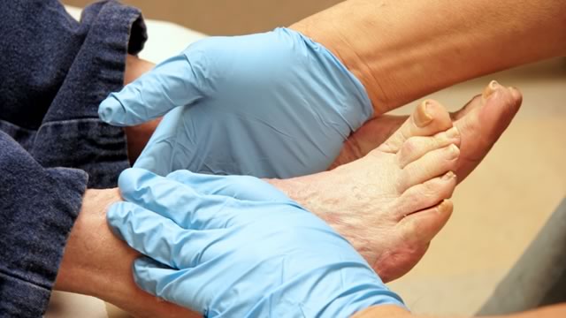 Раны на ногах при сахарном диабете между пальцами ног