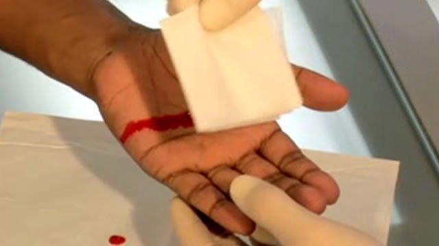 Головокружение при кровотечении из раны
