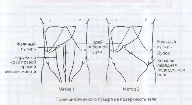 Колит желчный пузырь что принять