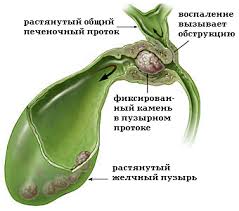 Почему при колите болит правый бок