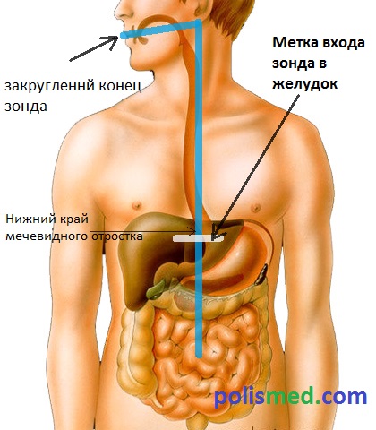 Как промыв желудок рвота