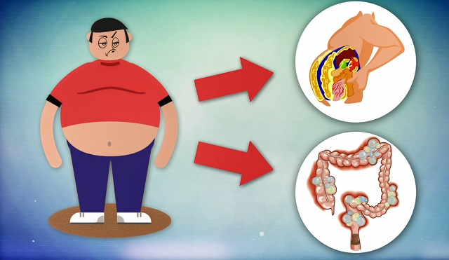 висцеральный жир